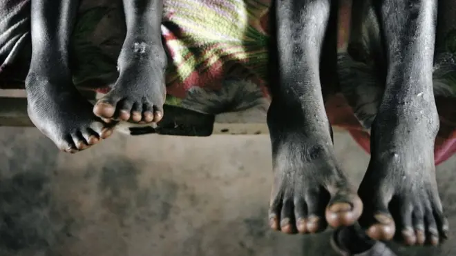Ноги детей Африки