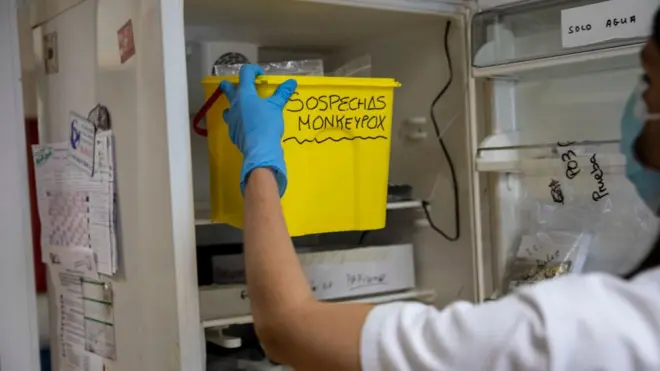 Muestras de la viruela del mono.