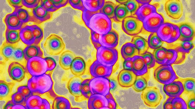 在當時，真正的死因尚未被看到：鏈球菌。