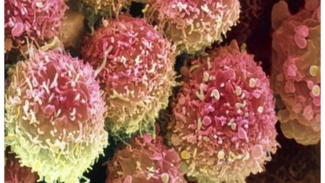 Abantu bashasha imiliyoni 13 nibo bandura indwara ya kanseri ku mwaka