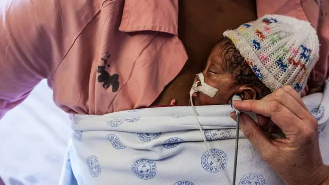 Près de 80 % des naissances prématurées ont lieu dans les pays à faible revenu.