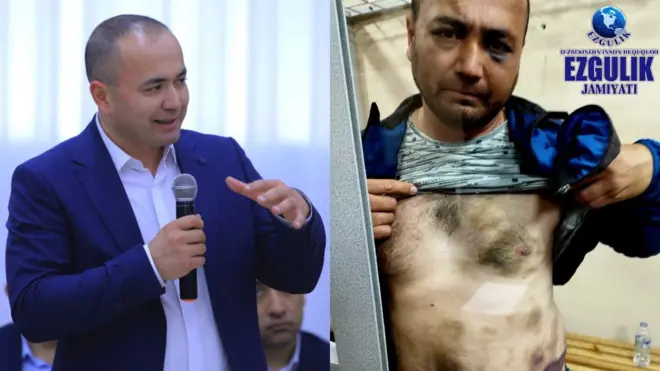 Адвокат Дилшод Тўрахўжаевдаги қийноқ изларини суд залида кўрганини айтмоқда