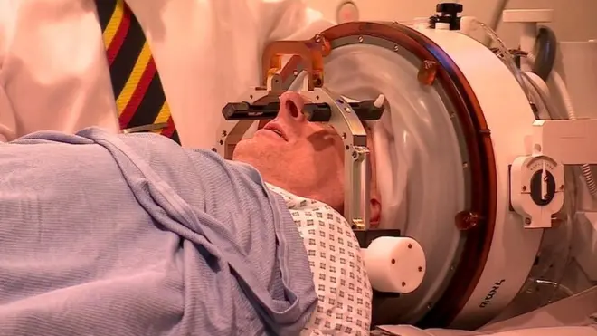 Lucas permaneció despierto durante todo el procedimiento.