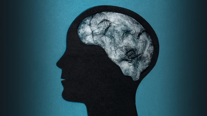 ภาพสแกนสมอง