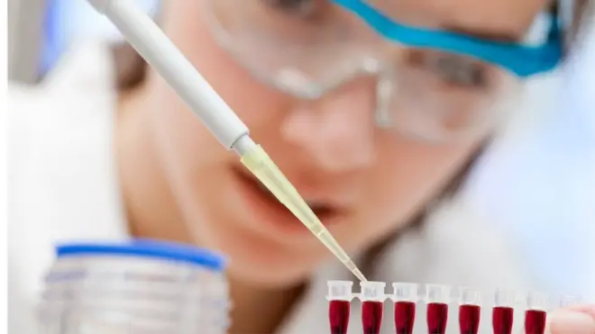 अल्जाइमर्स