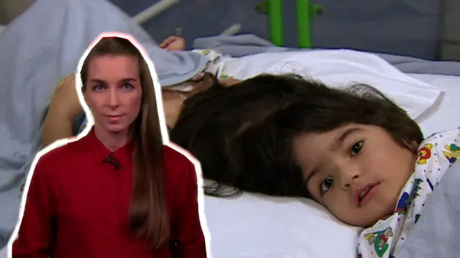 сіамські близнюки