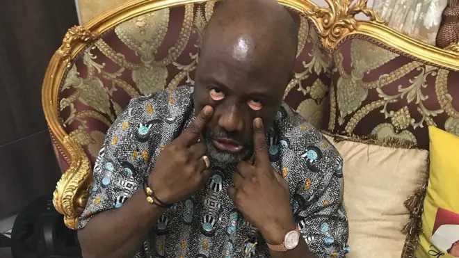 Senator Dino Melaye share dis picture for im Instagram as federal government nack court case for im head