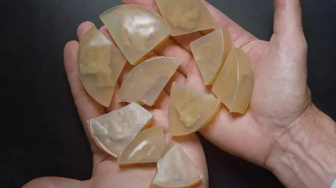 El cerebro de Albert Einstein, posteriormente disecado, fue removido por el patólogo Thomas Harvey poco después de su muerte, junto con sus ojos.