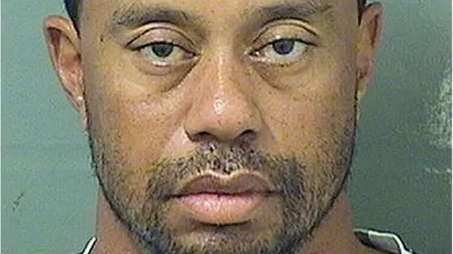 Tiger Woods sedang dalam proses pemulihan dari cedera lututnya.