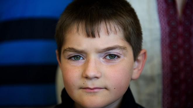 Foto em primeiro plano de Dennis, criança ucraniana de 9 anos com câncer