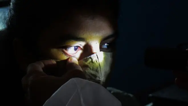 ब्लैक फंगस