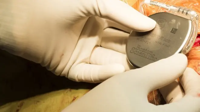 Existen distintos tipos de dispositivos que se colocan en el corazón para responder a diversos tipos de problemas cardiacos.