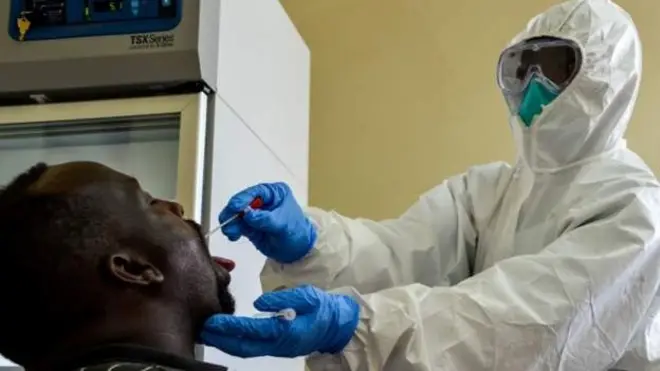 ምርመራ ኮሮናቫይረስ