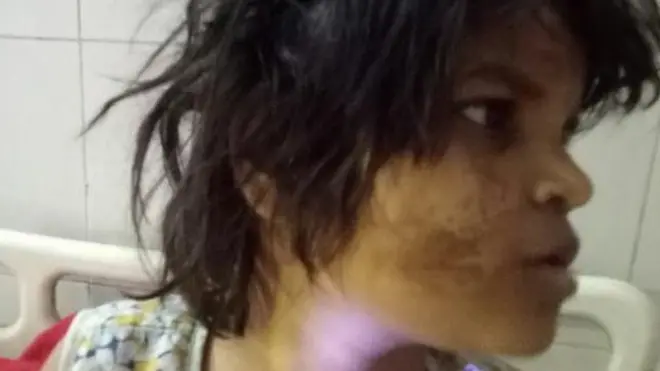 انڈیا میں اتر پردیش کی ریاست سے ملنے والی بچی