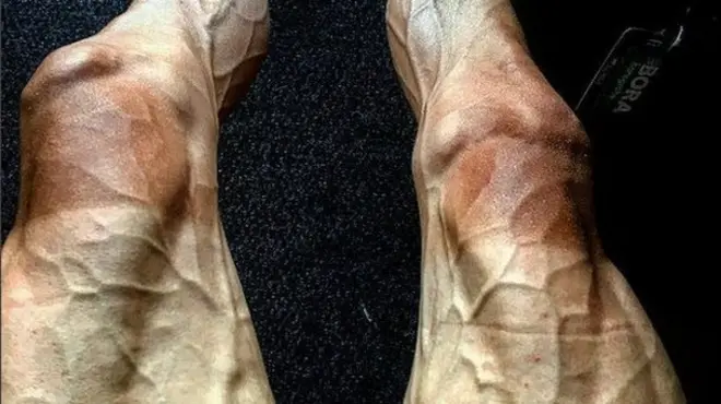 A picture of Pawel Poljanski's legs, captioned: "After sixteen stages I think my legs look little tired."