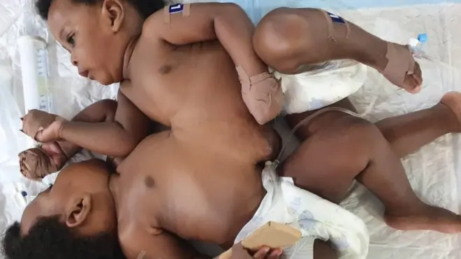 Tagwayen da aka haifa a manne a Yola