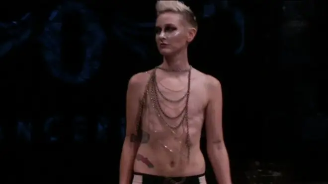 Mujer con mastectomía