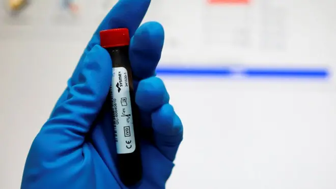 Допинг-тест