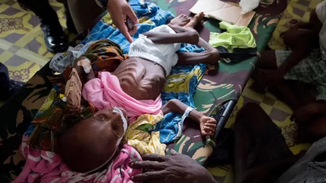 Bayi dan keluarga penderita kelaparan Agats