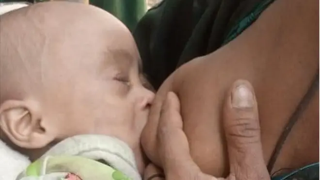 ጡት የሚጠባ ሕጻን