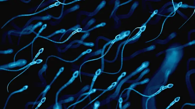 Sperm