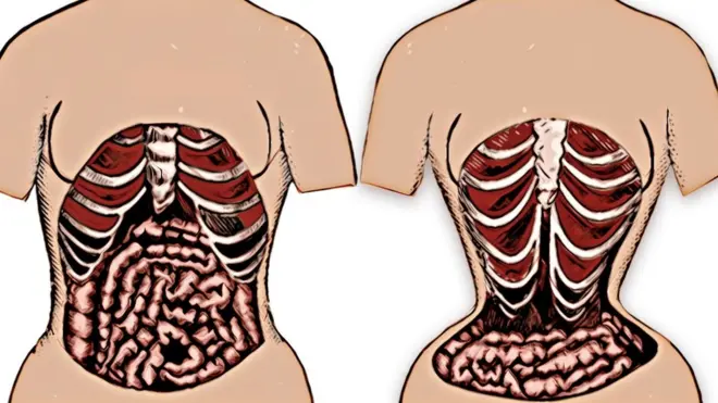 Ihe 'waist trainer' na-eme ndị yiri ya