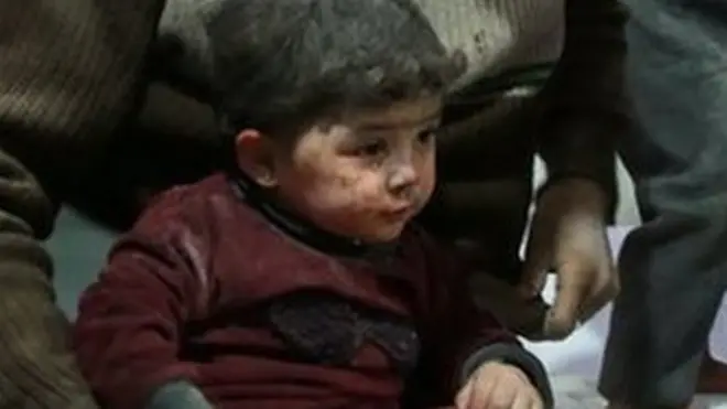 مشرقی غوطہ میں مرنے والوں میں 121 بچے شامل ہیں