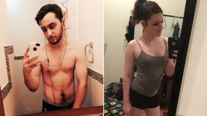 Gwen hormon tedavisiyle kadın oldu.