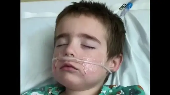 Un enfant souffrant du coronavirus, sous respirateur.