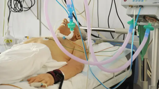 реанимация