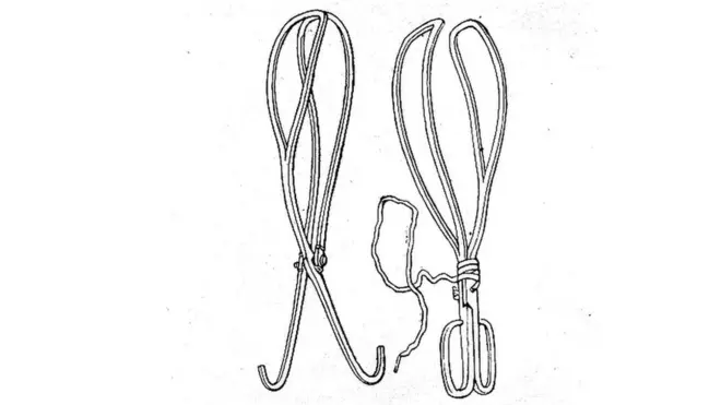 Con sus fórceps, los Chamberlen evitaban tener que enfrentar a las familias tan a menudo con el dilema de decidir si salvar a la madre o al bebé.