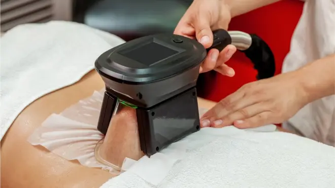 Unwanted fat is frozen in a clamp during cryolipolysis