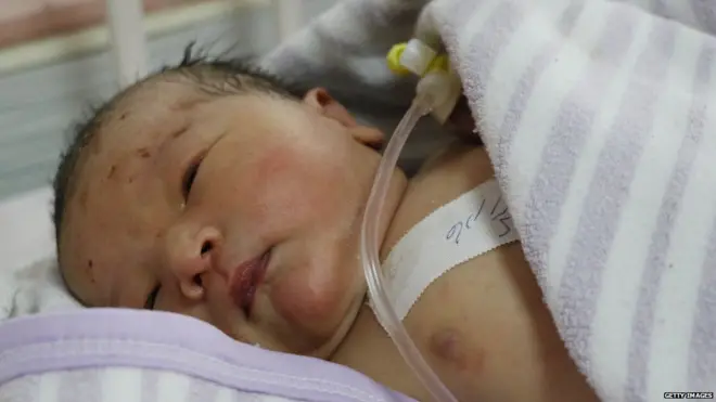 क़ाबुल हमले में सुरक्षित बचाए गए नवजात बच्चों को एक अन्य अस्पताल में भेजा गया है,जहां उनका इलाज चल रहा है.