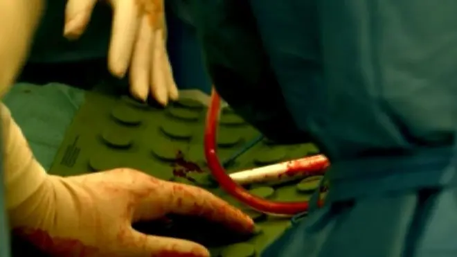 Нелегальная торговля органами