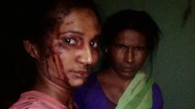 बाघ से भिड़ंत-सेल्फी-रूपाली