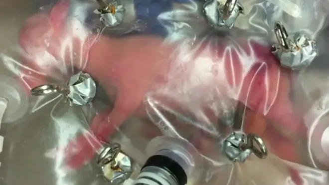 دانشمندان در یک قدمی ساختن رحم مصنوعی هستند