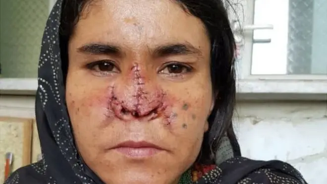 Zaarkaa ohospitaala osoo jirtuu