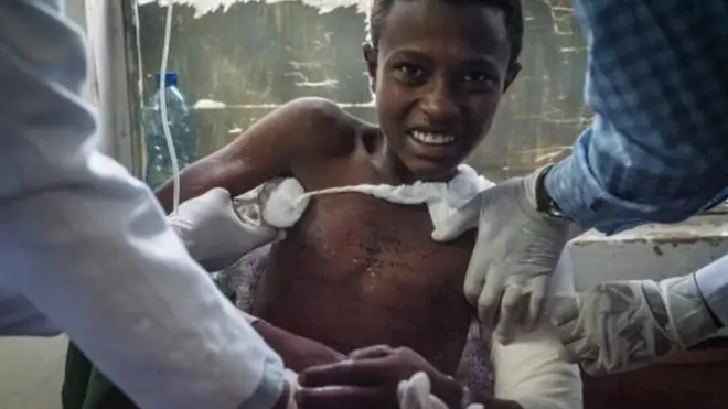 Ol-adeemaa boombiin miidhame