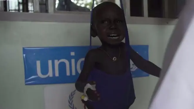 منظمة الامم المتحدة للطفولة قالت أن المجاعة قد تقتل ربع مليون طفل من جنوب السودان اذا لم يتم تسليم المساعدات الغذائية العاجلة لهم