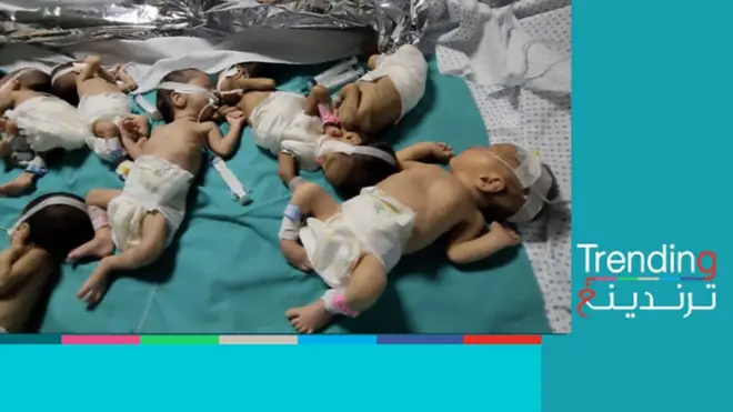 أطفال خدج في مستشفى الشفاء