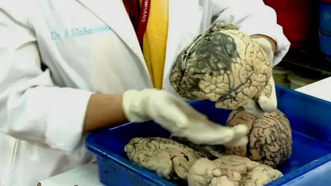మనిషి మెదడు