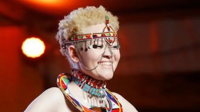 Такмичење за Мис Албино