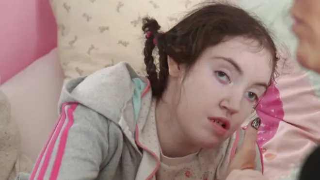 Bridget Buck, de 19 años, nació con discapacidad severa después de que su madre siguiera un tratamiento con valproato de sodio.