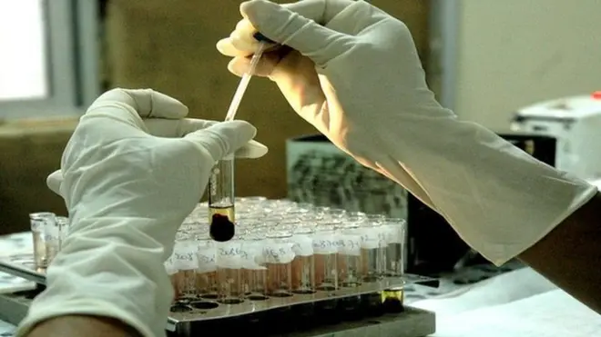 Quy trình xét nghiệm HIV thường rất nghiêm ngặt