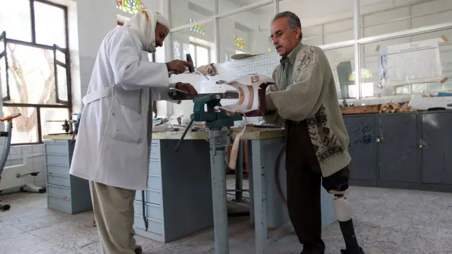 أحد ذوي الإعاقة اليمنيين يتلقى المساعدة في مركز الأطراف الاصطناعية بصنعاء