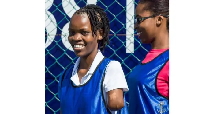 Dorcas Kero alizaliwa na mikono yake miwili miaka 31 iliyopita katika kaunti ya Taita-Taveta pwani ya Kenya lakini sasa hana mkono wake wa kushoto.