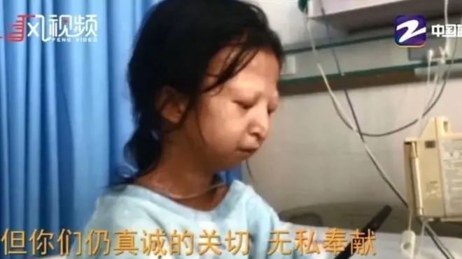 24 ఏళ్ల వయసులో హుయాన్ 20 కేజీలే బరువే ఉన్నారు