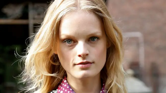 Hanne Gaby Odiele se sometió a dos grandes cirugías cuando era niña y adolescente.
