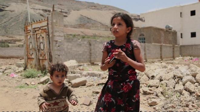 الأمم المتحدة تقول إن اليمن سيواجه أكبر مجاعة في العالم