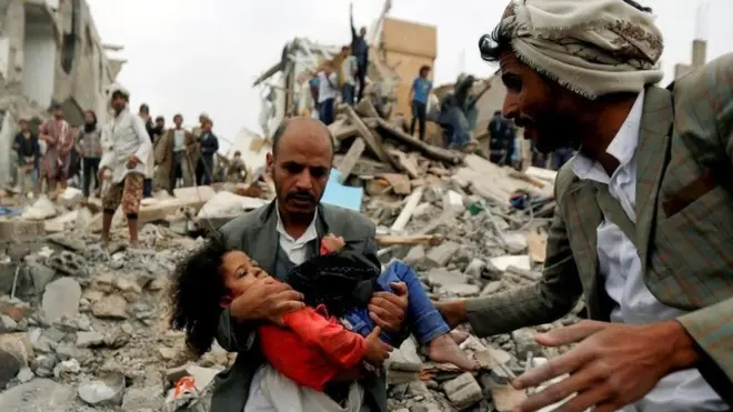 సౌదీ నేతృత్వంలో జరిగిన వైమానిక దాడుల్లో ఎనిమిది మంది కుటుంబ సభ్యులను కోల్పోయిన యెమెన్‌లోని సనాకు చెందిన బాలిక (2017 నాటి చిత్రం)